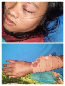 Terjadi Di Purwakarta, Pulang Ngamen Ibu Muda Beranak 4 Babak Belur Dihajar Suami hingga Urat Nadi Nyaris Putus